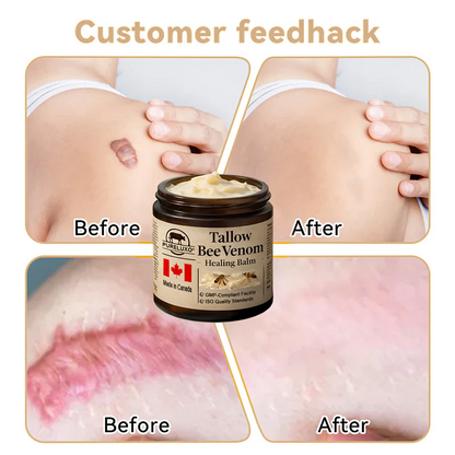 【70% OFF Ends Today】Pureluxo® Tallow Bee Venom Healing Balm（Targets Bumps, Wrinkles & Stressed Skin — Without Steroids）