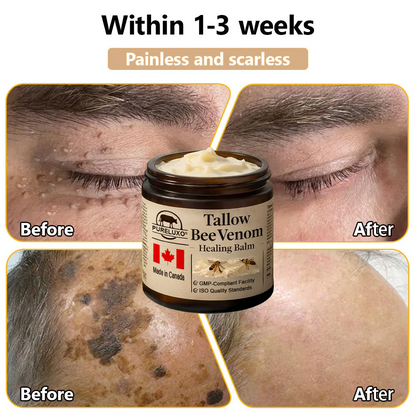 【70% OFF Ends Today】Pureluxo® Tallow Bee Venom Healing Balm（Targets Bumps, Wrinkles & Stressed Skin — Without Steroids）