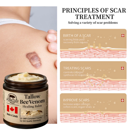 【70% OFF Ends Today】Pureluxo® Tallow Bee Venom Healing Balm（Targets Bumps, Wrinkles & Stressed Skin — Without Steroids）