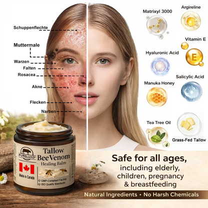 【70% OFF Ends Today】Pureluxo® Tallow Bee Venom Healing Balm（Targets Bumps, Wrinkles & Stressed Skin — Without Steroids）