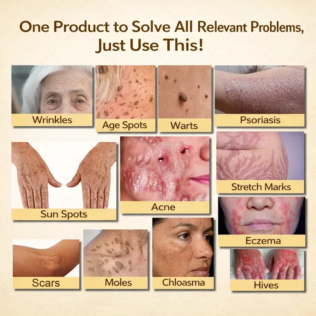 【70% OFF Ends Today】Pureluxo® Tallow Bee Venom Healing Balm（Targets Bumps, Wrinkles & Stressed Skin — Without Steroids）