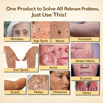 【70% OFF Ends Today】Pureluxo® Tallow Bee Venom Healing Balm（Targets Bumps, Wrinkles & Stressed Skin — Without Steroids）