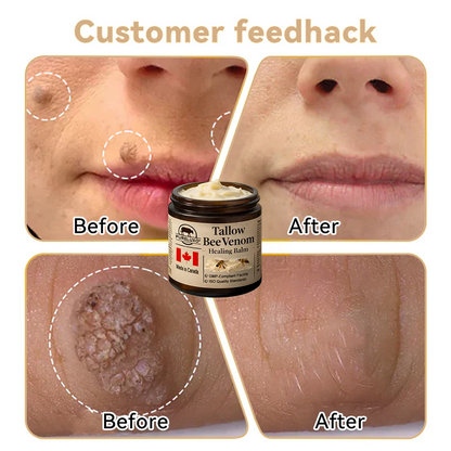 【70% OFF Ends Today】Pureluxo® Tallow Bee Venom Healing Balm（Targets Bumps, Wrinkles & Stressed Skin — Without Steroids）
