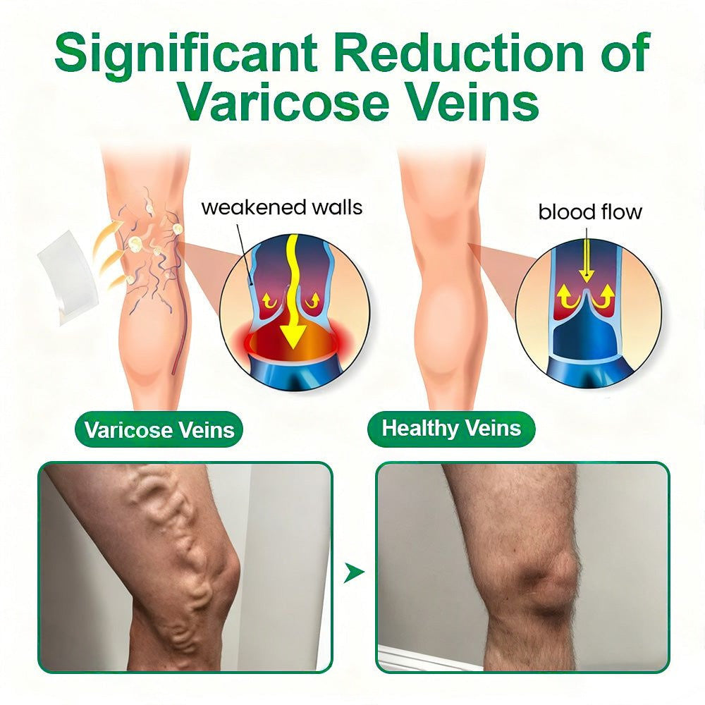 [FDA-Registered & GMP Certified]| 𝙋𝙪𝙧𝙚𝙡𝙪𝙭𝙤® 🇺🇸VeinTarget Microneedle Patch⚡Instant Relief, Long-Term Results