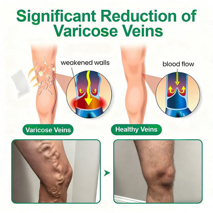 [FDA-Registered & GMP Certified]| 𝙋𝙪𝙧𝙚𝙡𝙪𝙭𝙤® 🇺🇸VeinTarget Microneedle Patch⚡Instant Relief, Long-Term Results